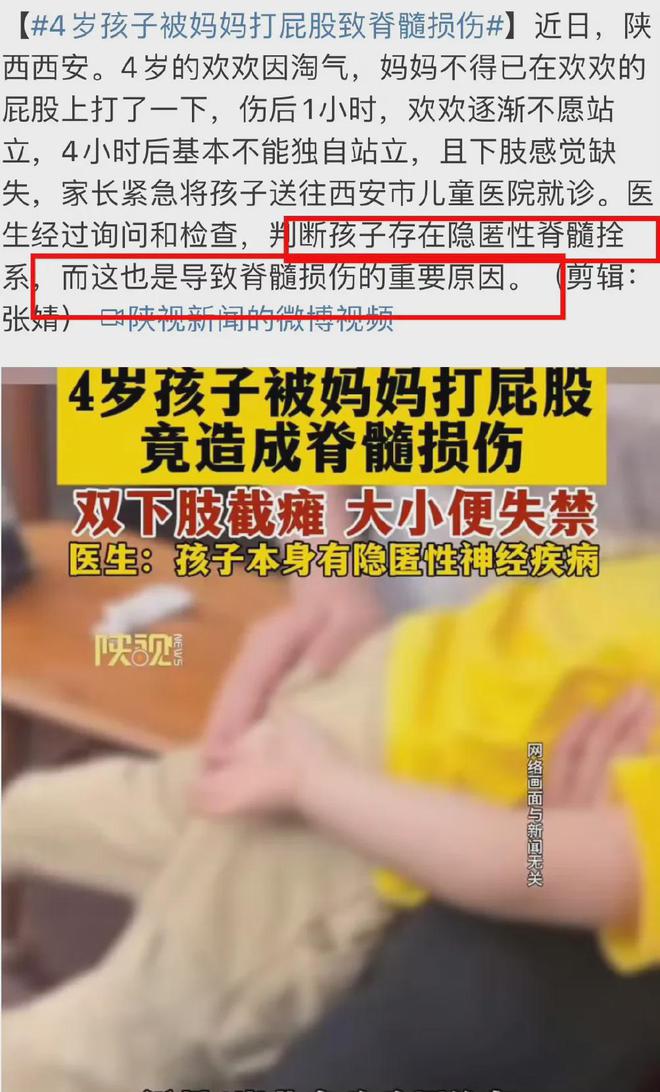 4岁孩子被妈妈打屁股致无法站立