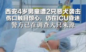 西安4岁男童遭恶犬袭击致昏迷