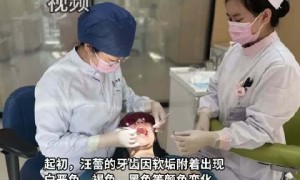 17岁女孩一天5瓶可乐泡腐15颗牙