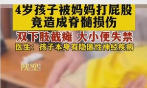 4岁孩子被妈妈打屁股致无法站立